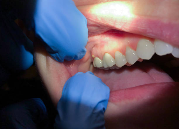 Best Emergency Cosmetic Dentistry (e.g., broken veneers) in Rosemead, CA