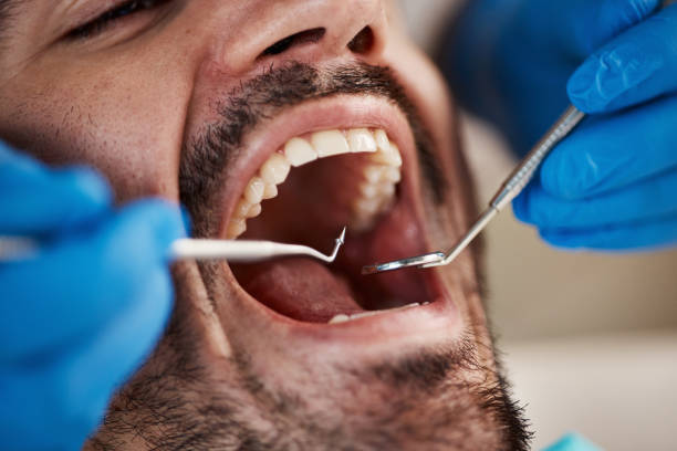 Best Emergency Denture Repair in Rosemead, CA